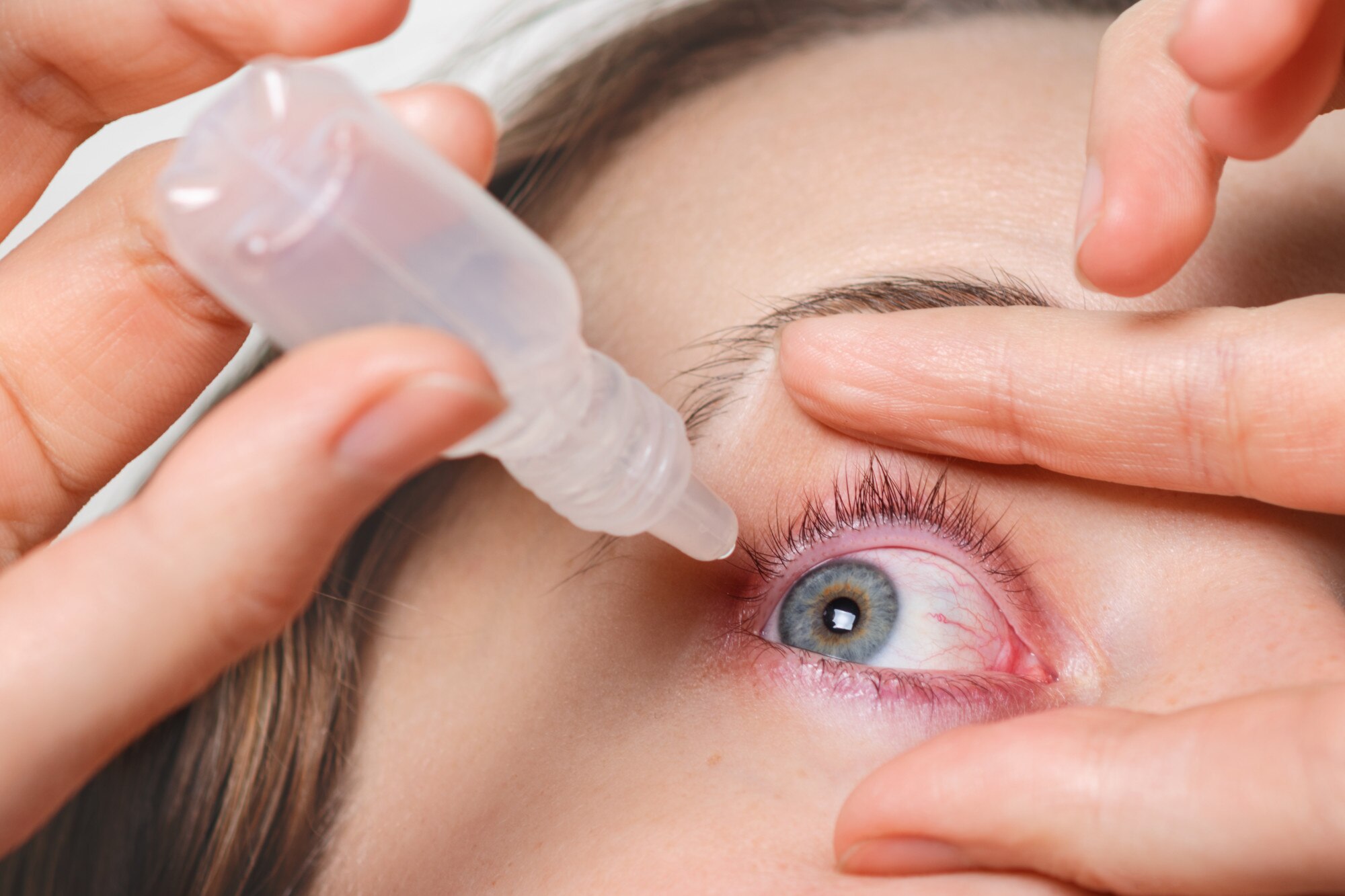 A person applies eye drops to their eye, using one hand to hold the eyelid open. The image illustrates proper eye care techniques.