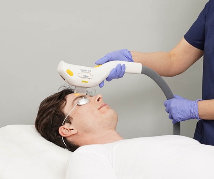 ipl-technology-for-dry-eyes